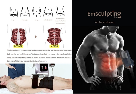 첨단 EMS 살림 기계 셀룰라이트 감소 150HZ 주파수