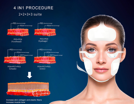 수직 자석 얼굴 Ems rf 피부 연소 피부 리프팅 튼튼 해소 Rf 리프팅 기계 machifor sal
